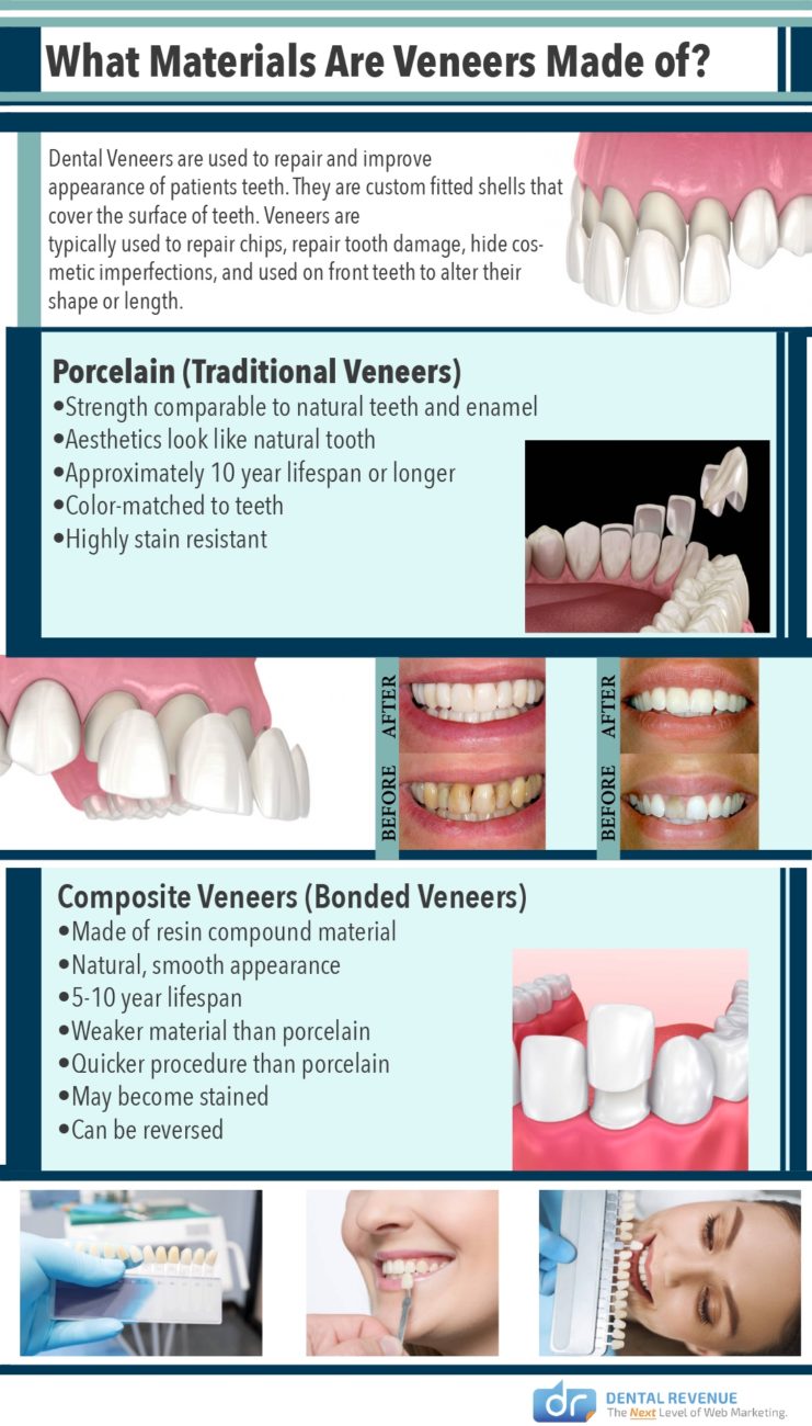 What Materials Are Veneers Made Of Infographic