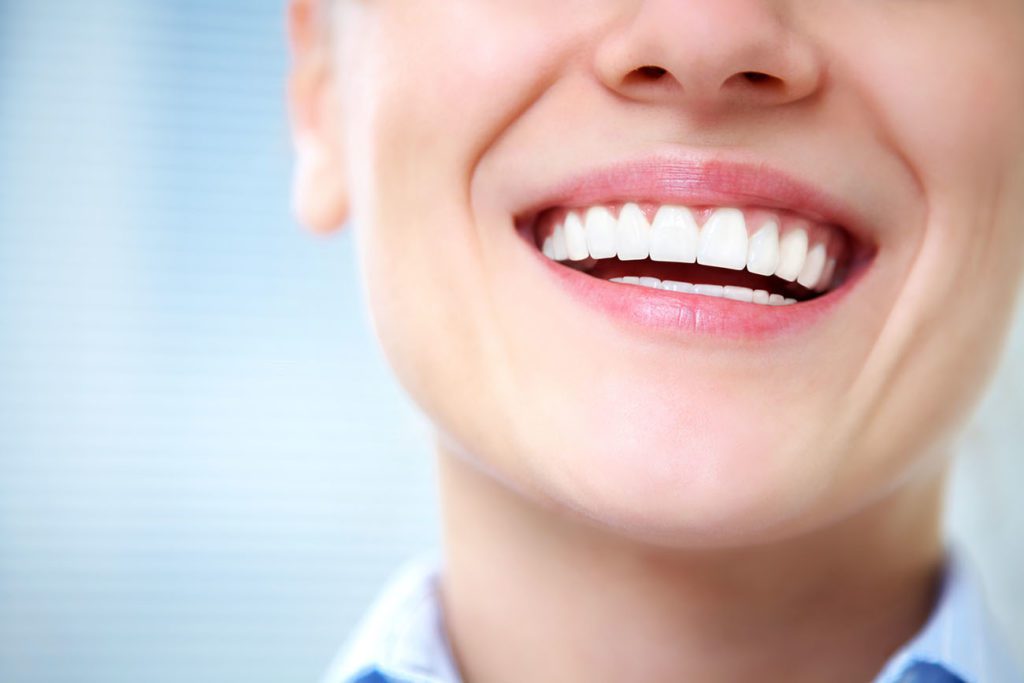 Close-up of smile with healthy teeth tongue tie dentist in Acton Massachusetts